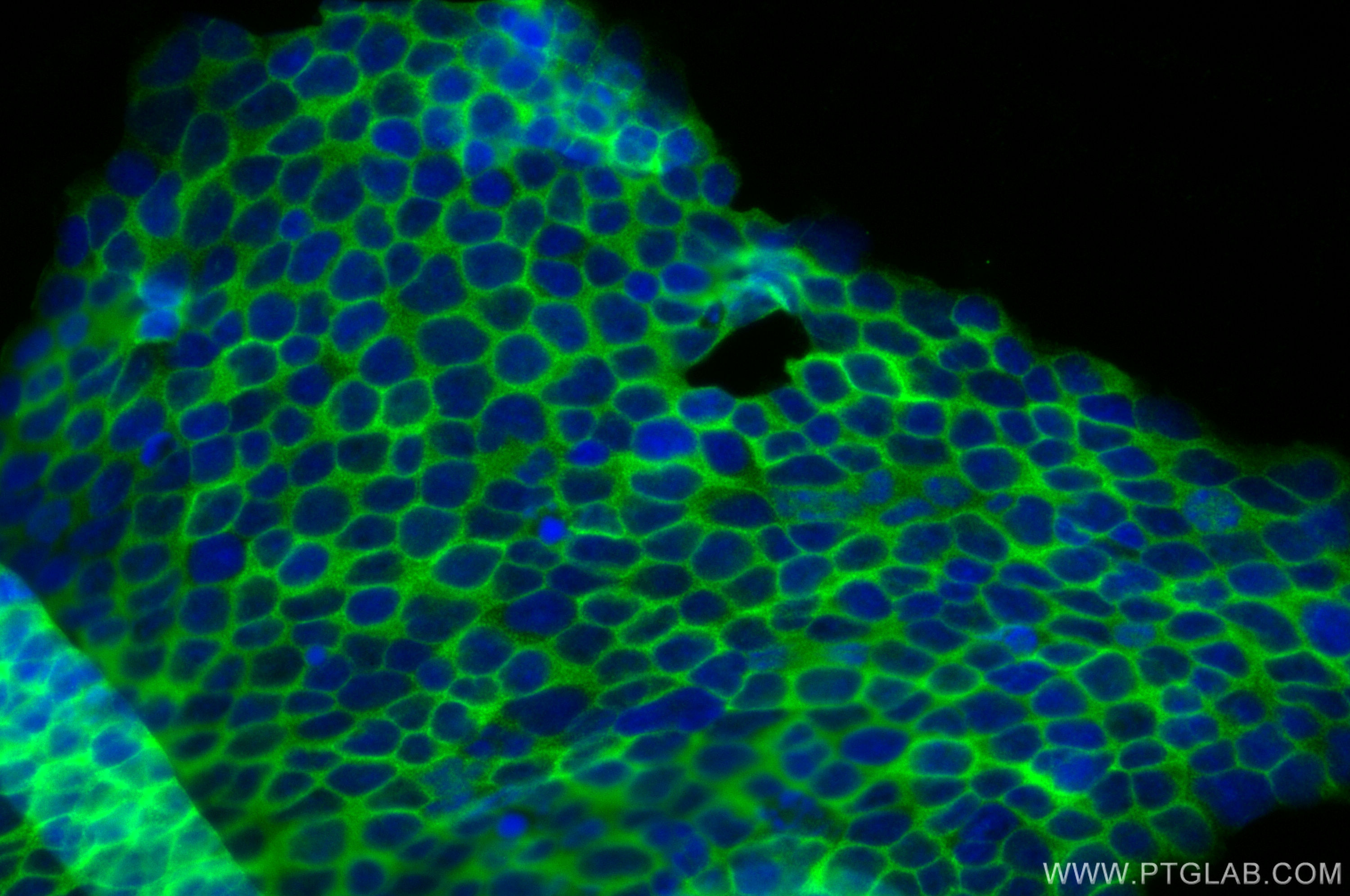 Immunofluorescence (IF) / fluorescent staining of Jurkat cells using ACAP1 Recombinant antibody (82967-4-RR)