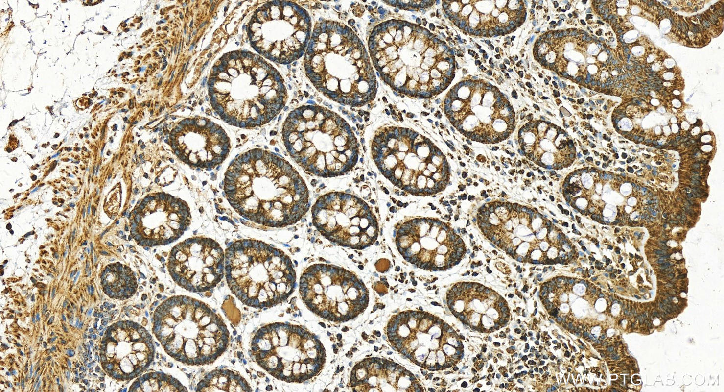 Immunohistochemistry (IHC) staining of human  colon using ACAT1 Polyclonal antibody (16215-1-AP)