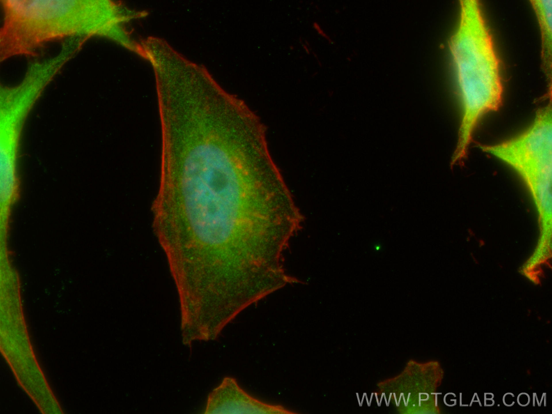 Immunofluorescence (IF) / fluorescent staining of HepG2 cells using ACAT2 Polyclonal antibody (14755-1-AP)