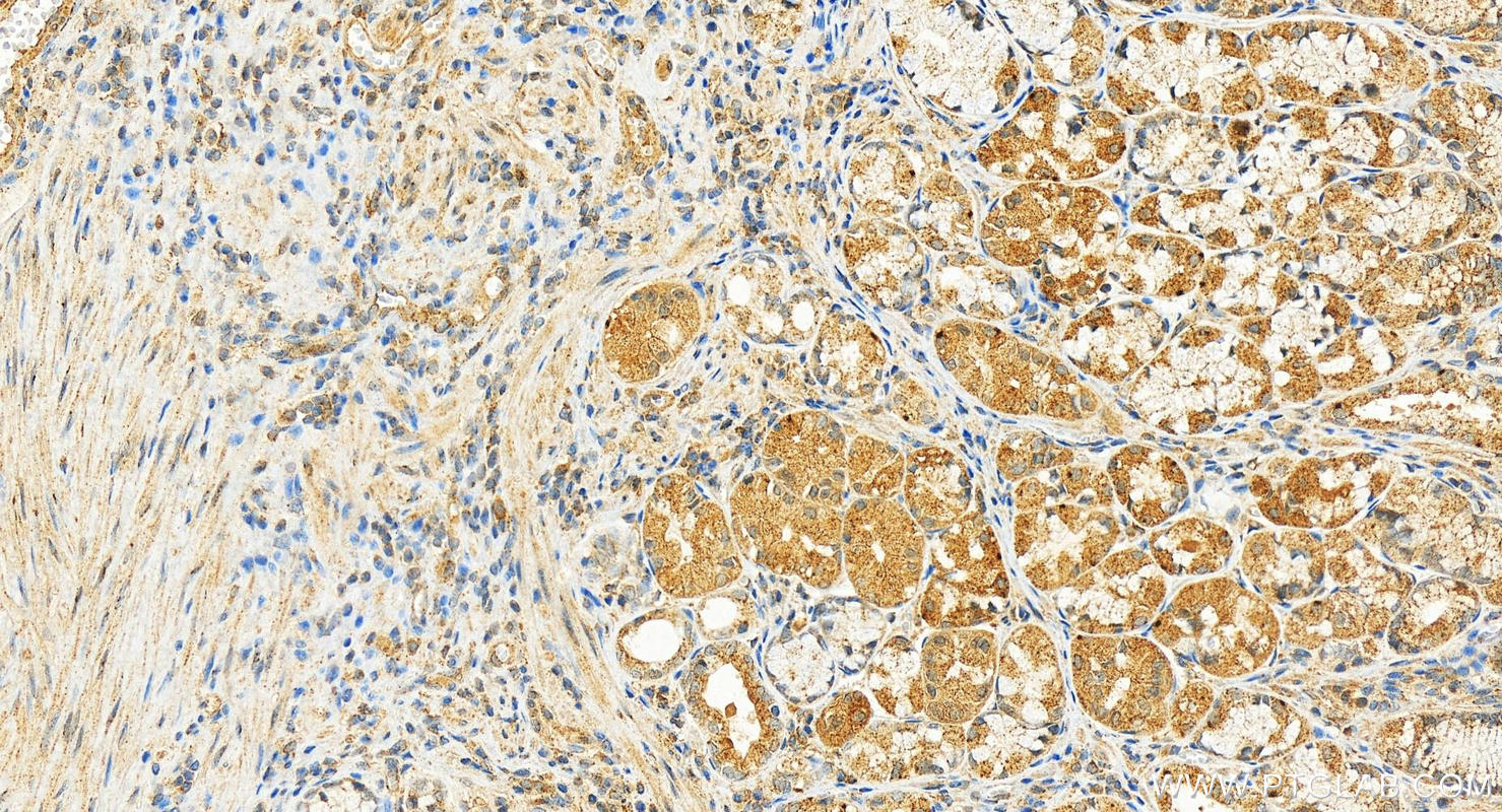 Immunohistochemistry (IHC) staining of human stomach tissue using ACBD5 Polyclonal antibody (21080-1-AP)