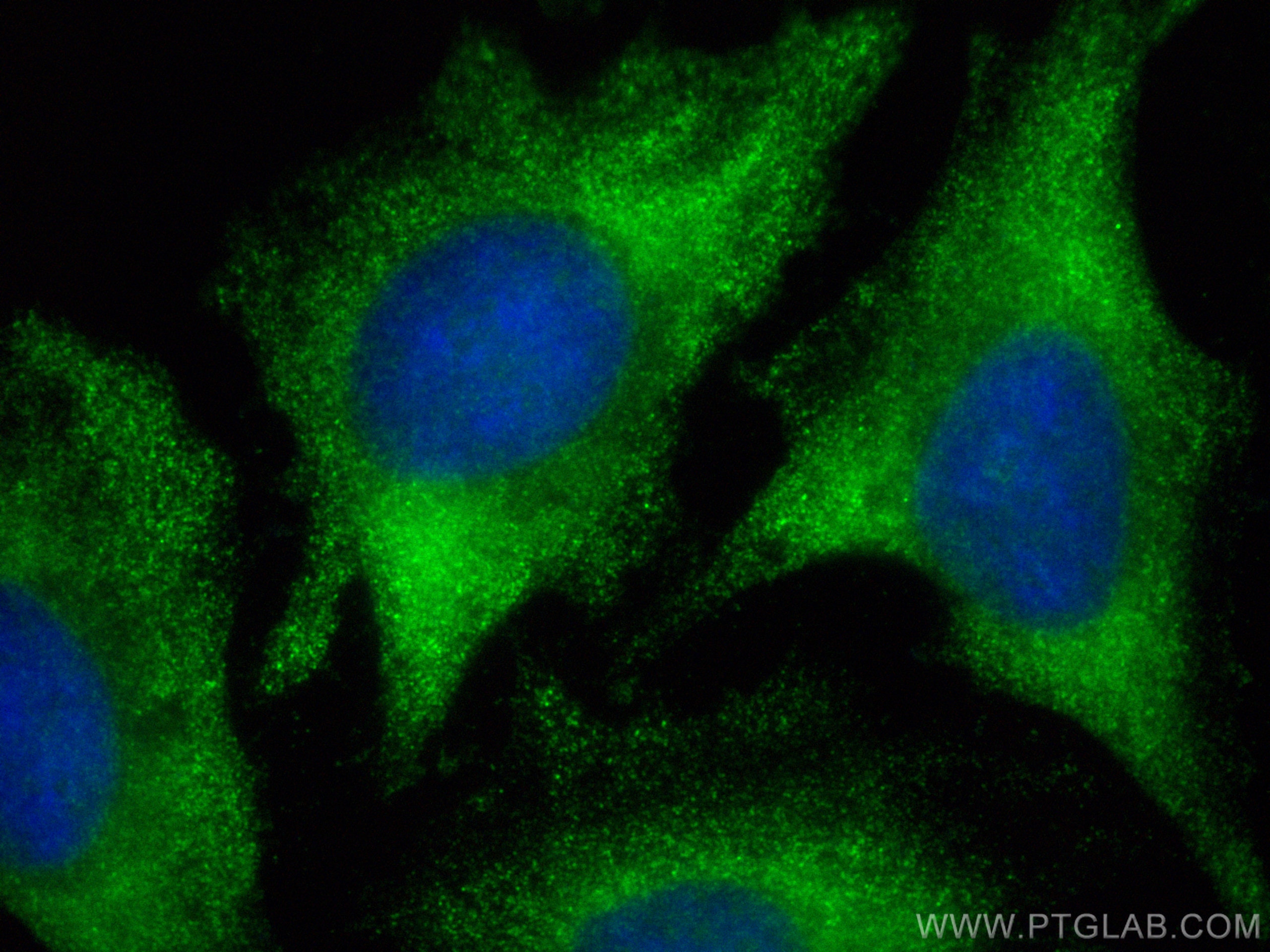 Immunofluorescence (IF) / fluorescent staining of HeLa cells using CoraLite® Plus 488-conjugated ACC1 Polyclonal anti (CL488-21923)