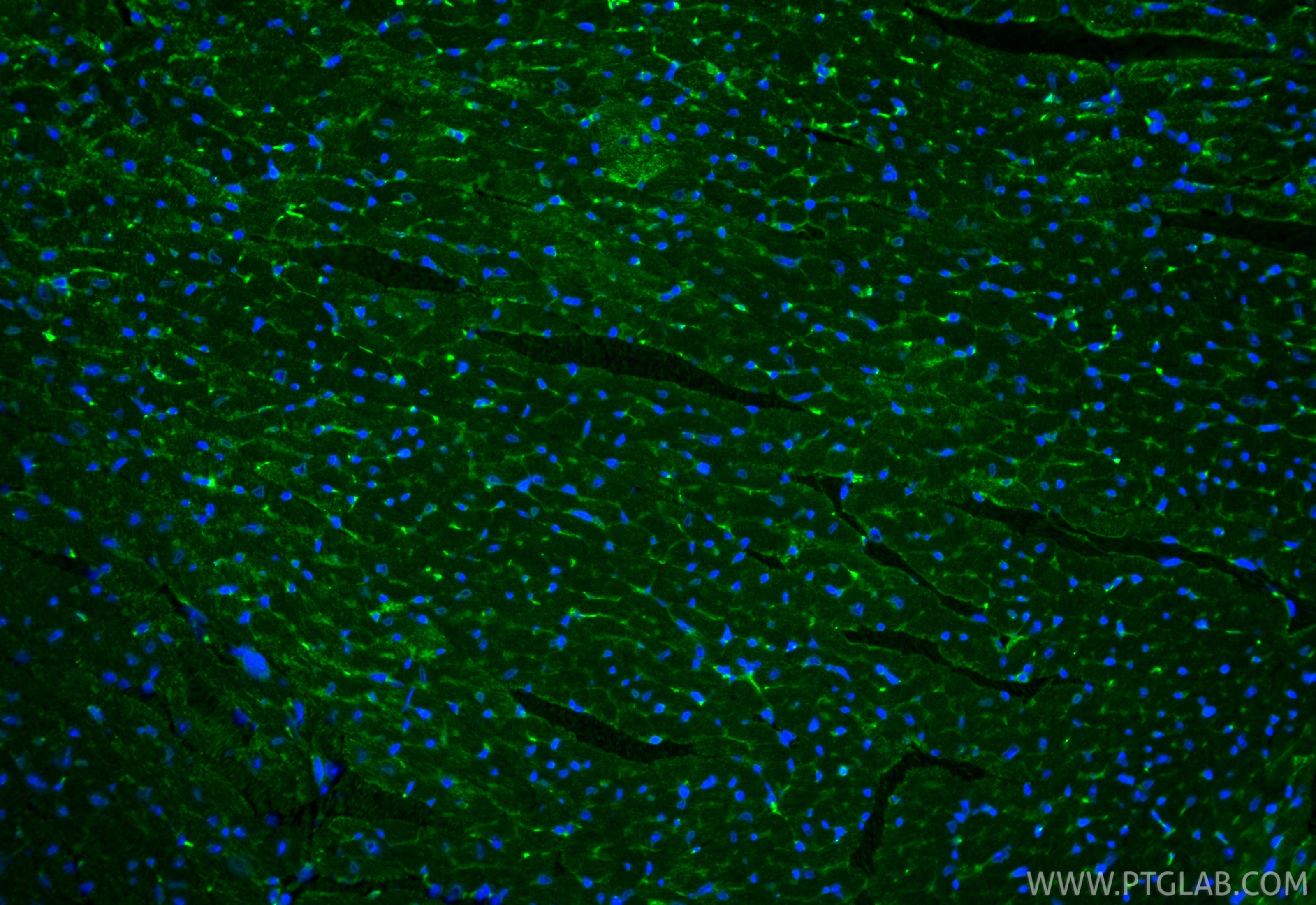 Immunofluorescence (IF) / fluorescent staining of mouse heart tissue using ACE Polyclonal antibody (24743-1-AP)