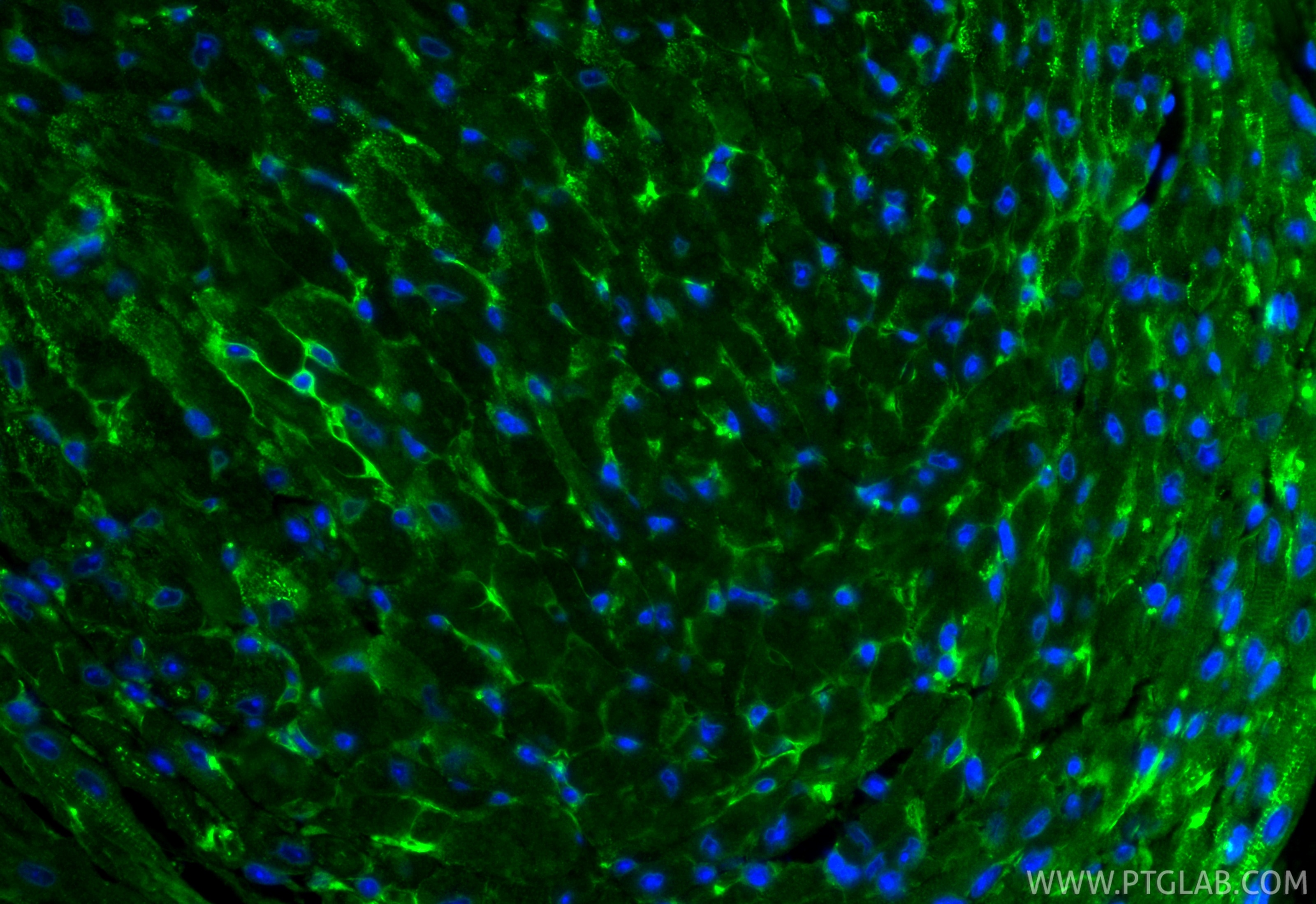Immunofluorescence (IF) / fluorescent staining of mouse heart tissue using ACE Polyclonal antibody (24743-1-AP)