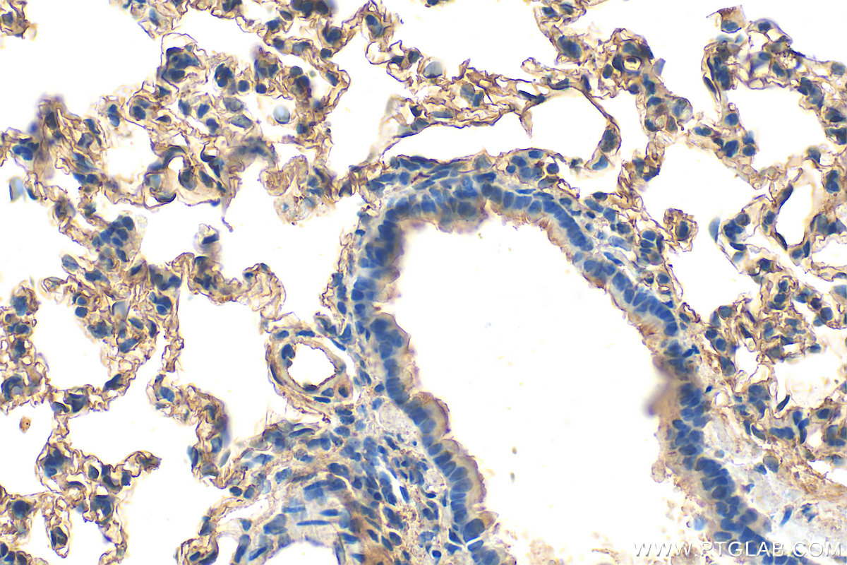 Immunohistochemistry (IHC) staining of rat lung tissue using ACE Polyclonal antibody (24743-1-AP)