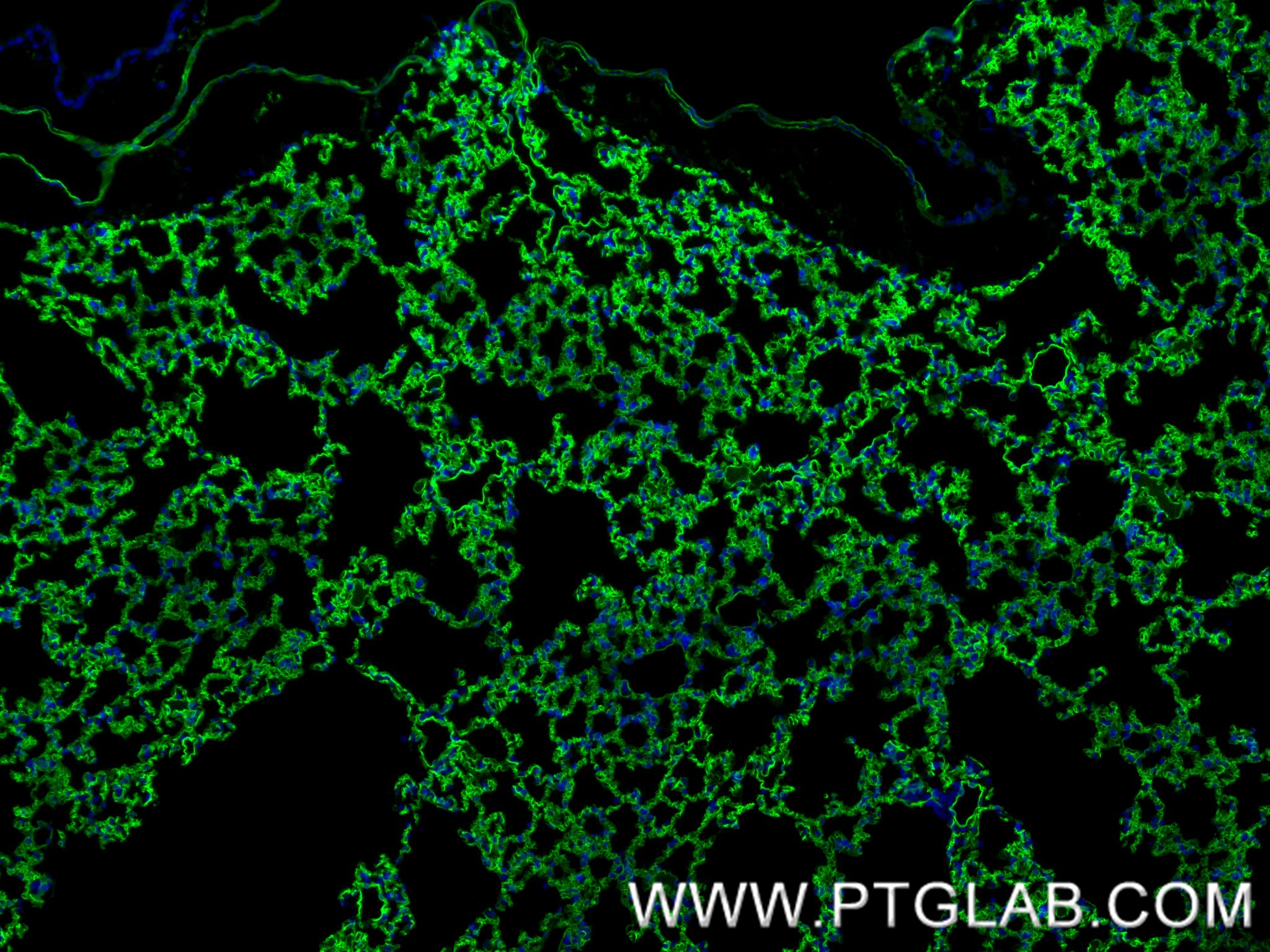 Immunofluorescence (IF) / fluorescent staining of mouse lung tissue using ACE Recombinant antibody (84407-4-RR)