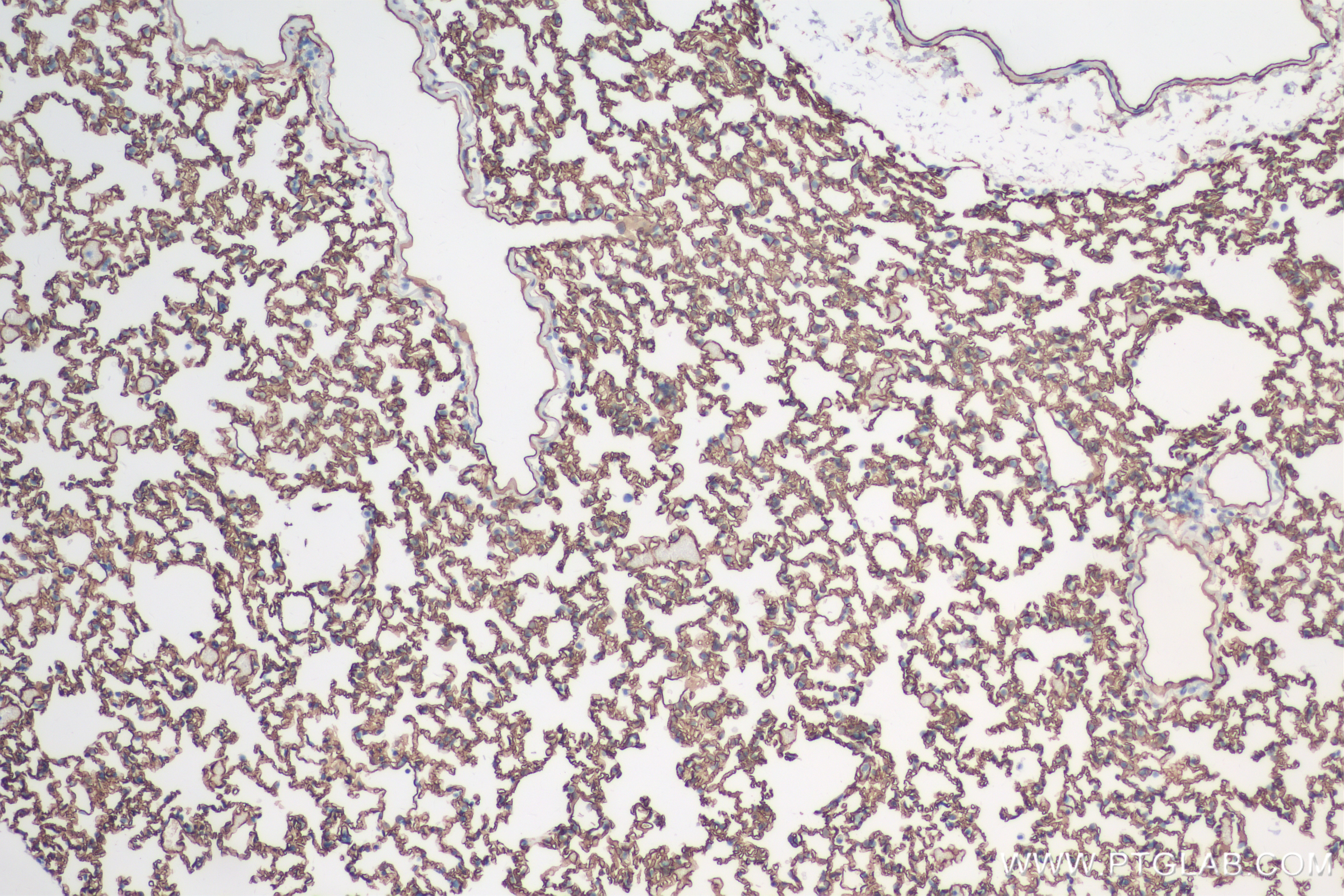 Immunohistochemistry (IHC) staining of rat lung tissue using ACE Recombinant antibody (84407-4-RR)