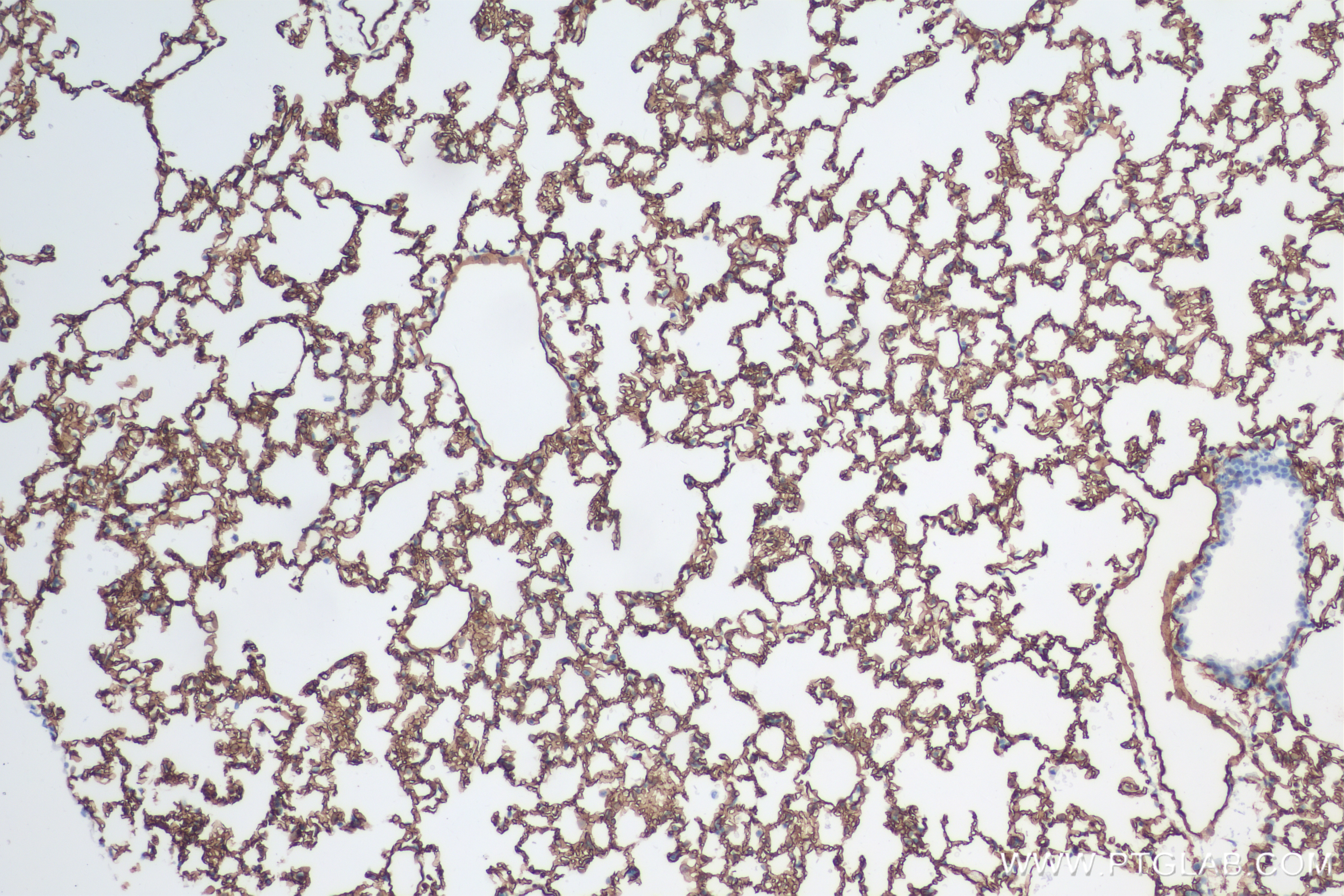 Immunohistochemistry (IHC) staining of mouse lung tissue using ACE Recombinant antibody (84407-4-RR)