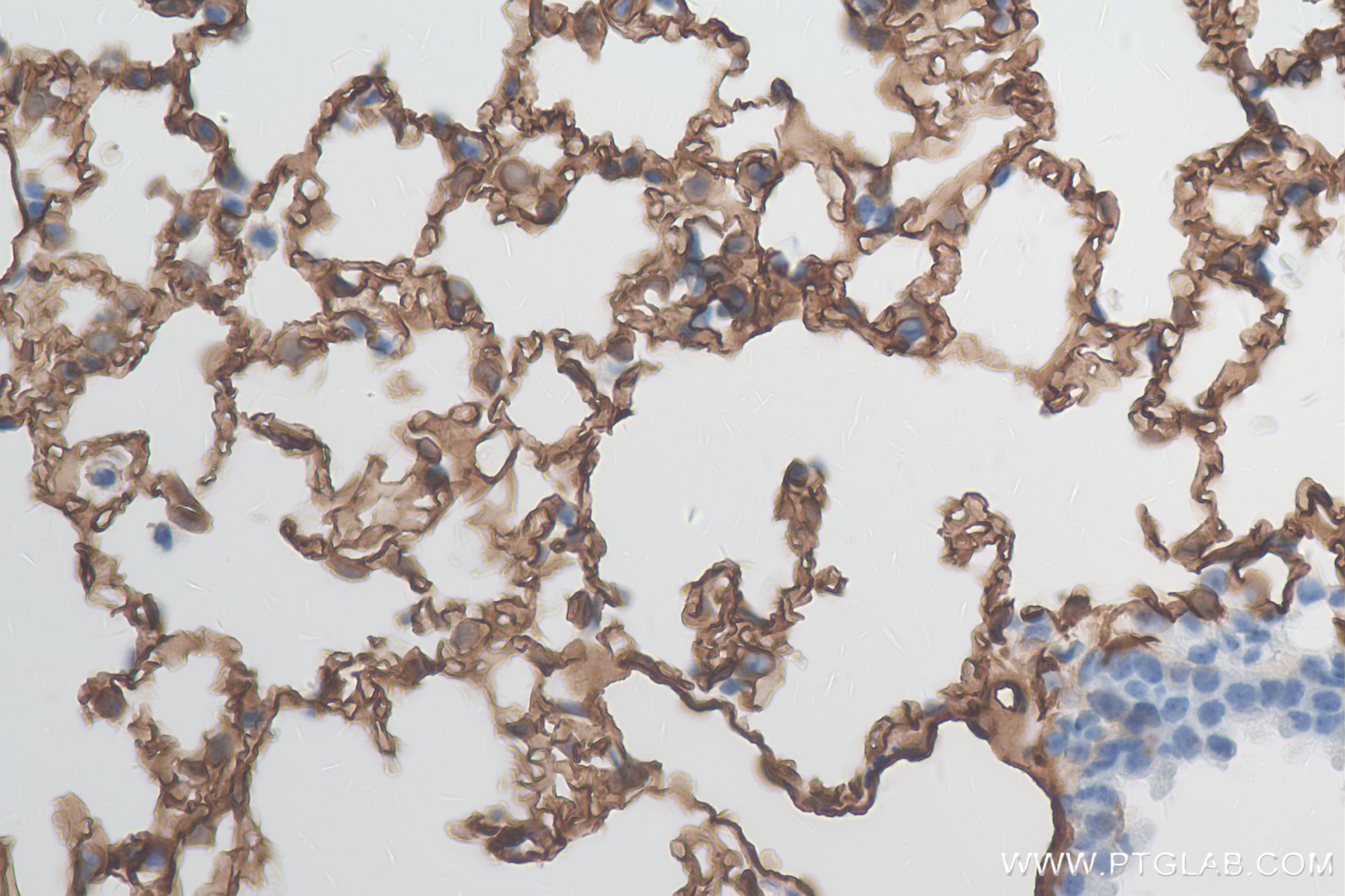 Immunohistochemistry (IHC) staining of mouse lung tissue using ACE Recombinant antibody (84407-4-RR)