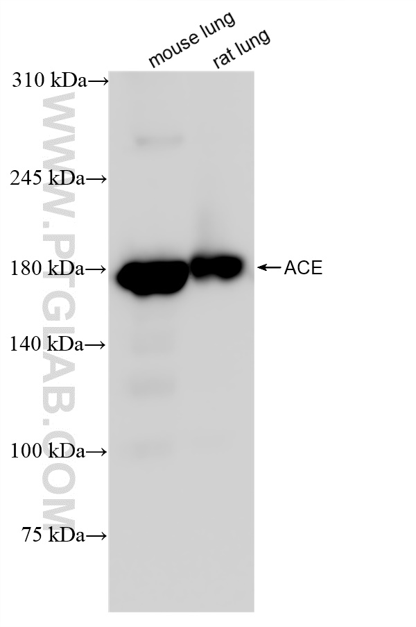 Western Blot (WB) analysis of various lysates using ACE Recombinant antibody (84407-4-RR)