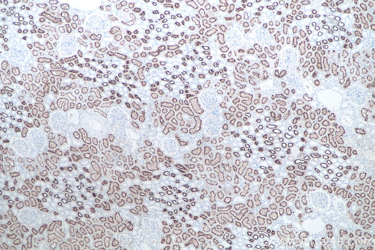 Immunohistochemistry (IHC) staining of human kidney tissue using ACE2 Polyclonal antibody (21115-1-AP)