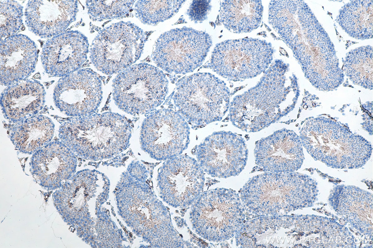 Immunohistochemistry (IHC) staining of mouse testis tissue using ACE2 Polyclonal antibody (21115-1-AP)