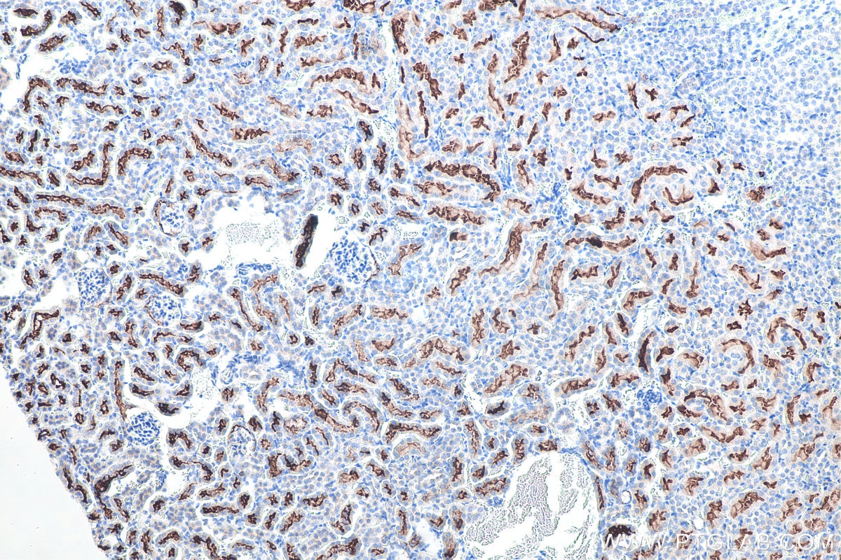 Immunohistochemistry (IHC) staining of mouse kidney tissue using ACE2 Polyclonal antibody (21115-1-AP)