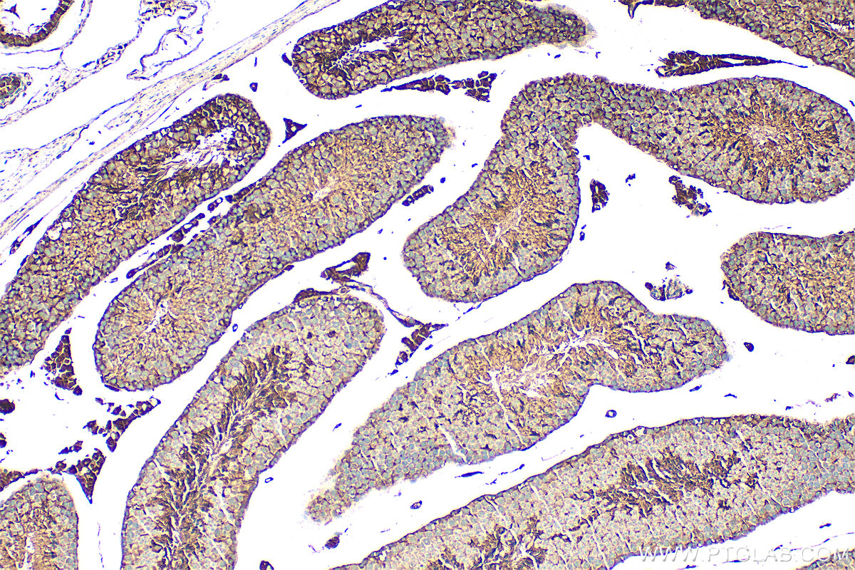 Immunohistochemistry (IHC) staining of mouse testis tissue using ACE2 Polyclonal antibody (31518-1-AP)