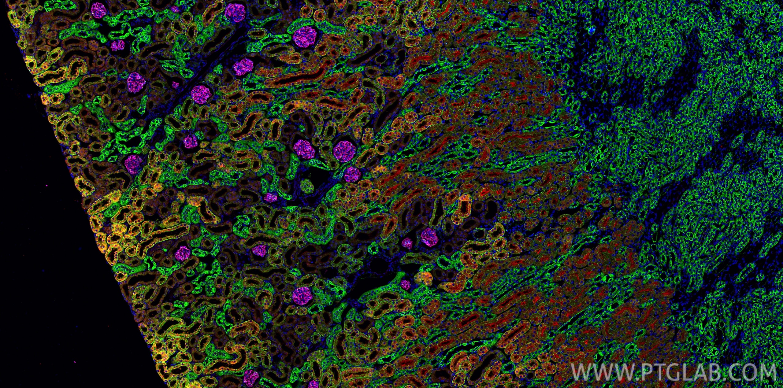Immunofluorescence (IF) / fluorescent staining of mouse kidney tissue using CoraLite®594-conjugated ACE2 Polyclonal antibody (CL594-21115)
