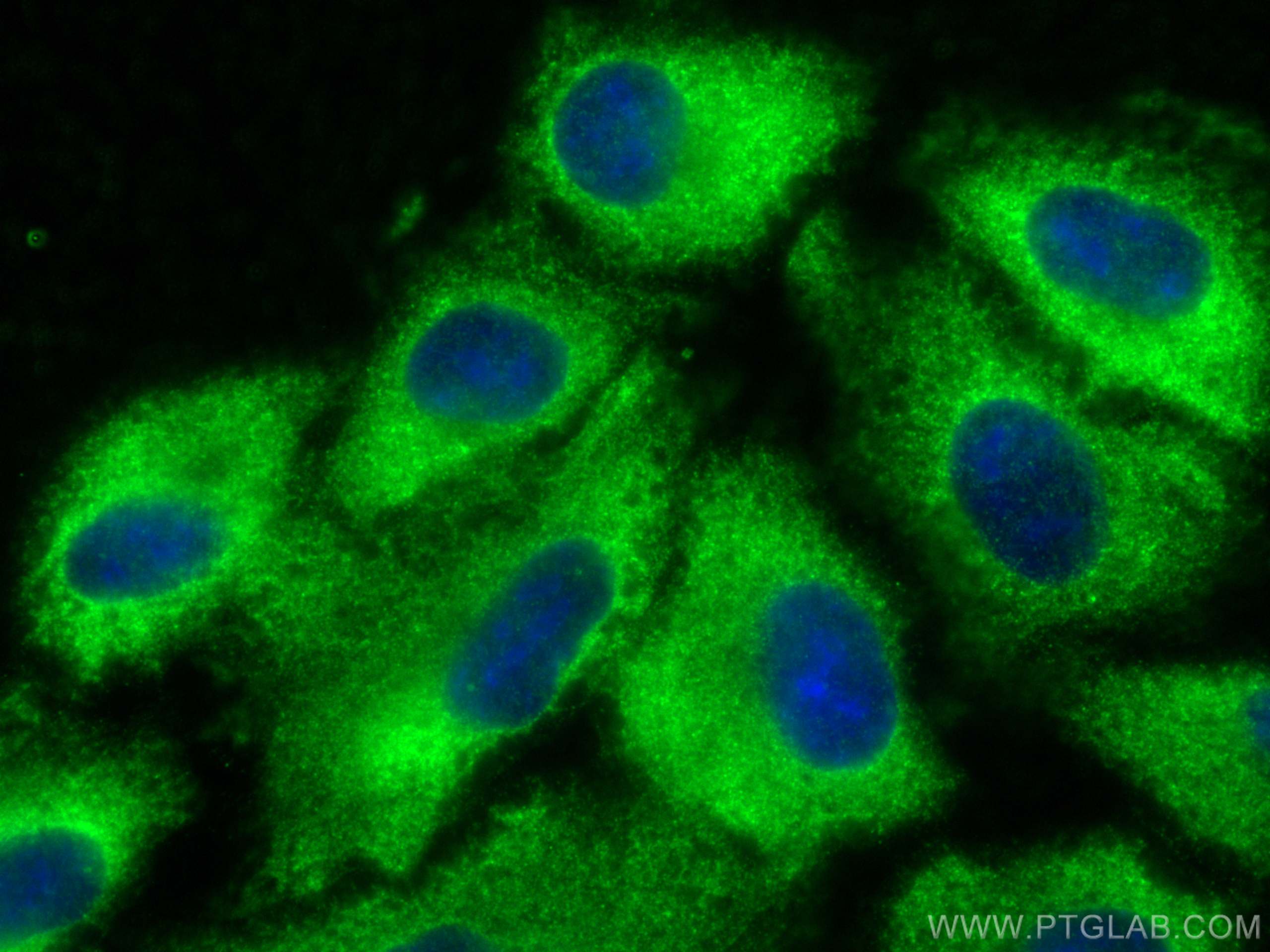 Immunofluorescence (IF) / fluorescent staining of A549 cells using ACLY Monoclonal antibody (67166-1-Ig)