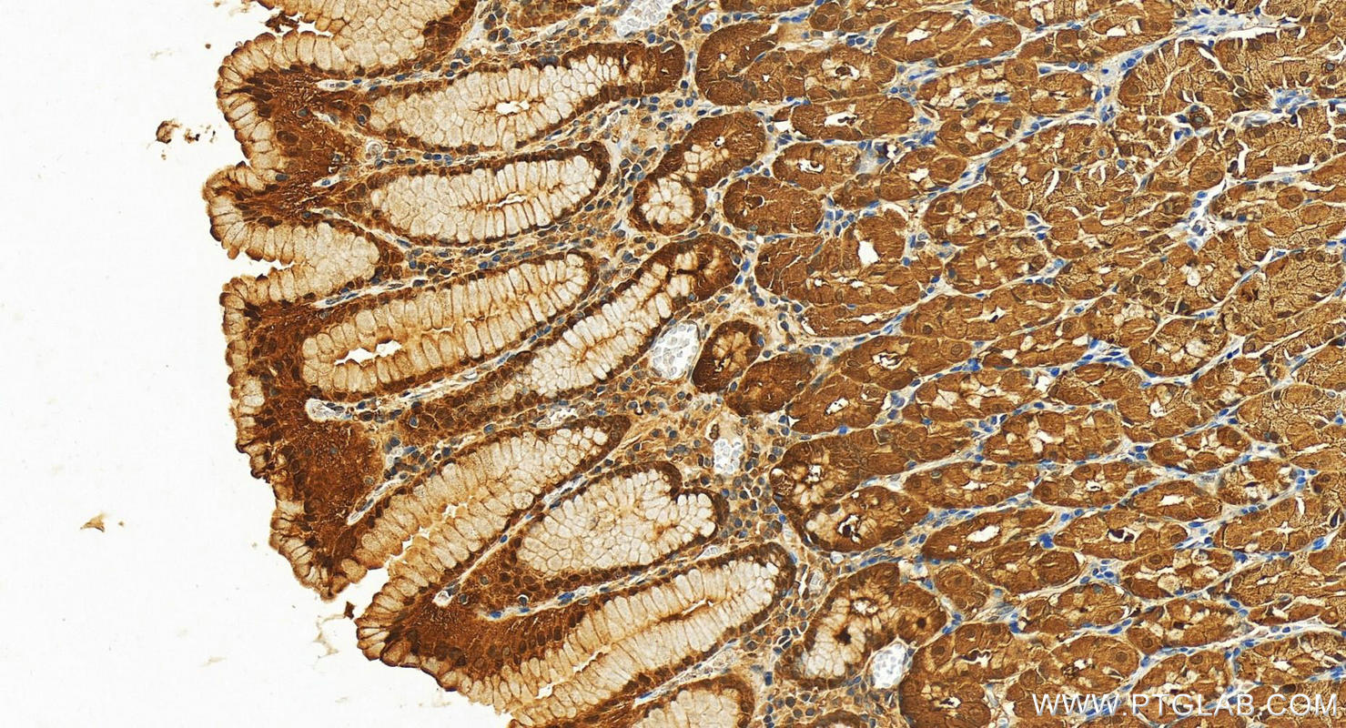 Immunohistochemistry (IHC) staining of human stomach tissue using Aconitase 1 Polyclonal antibody (12406-1-AP)