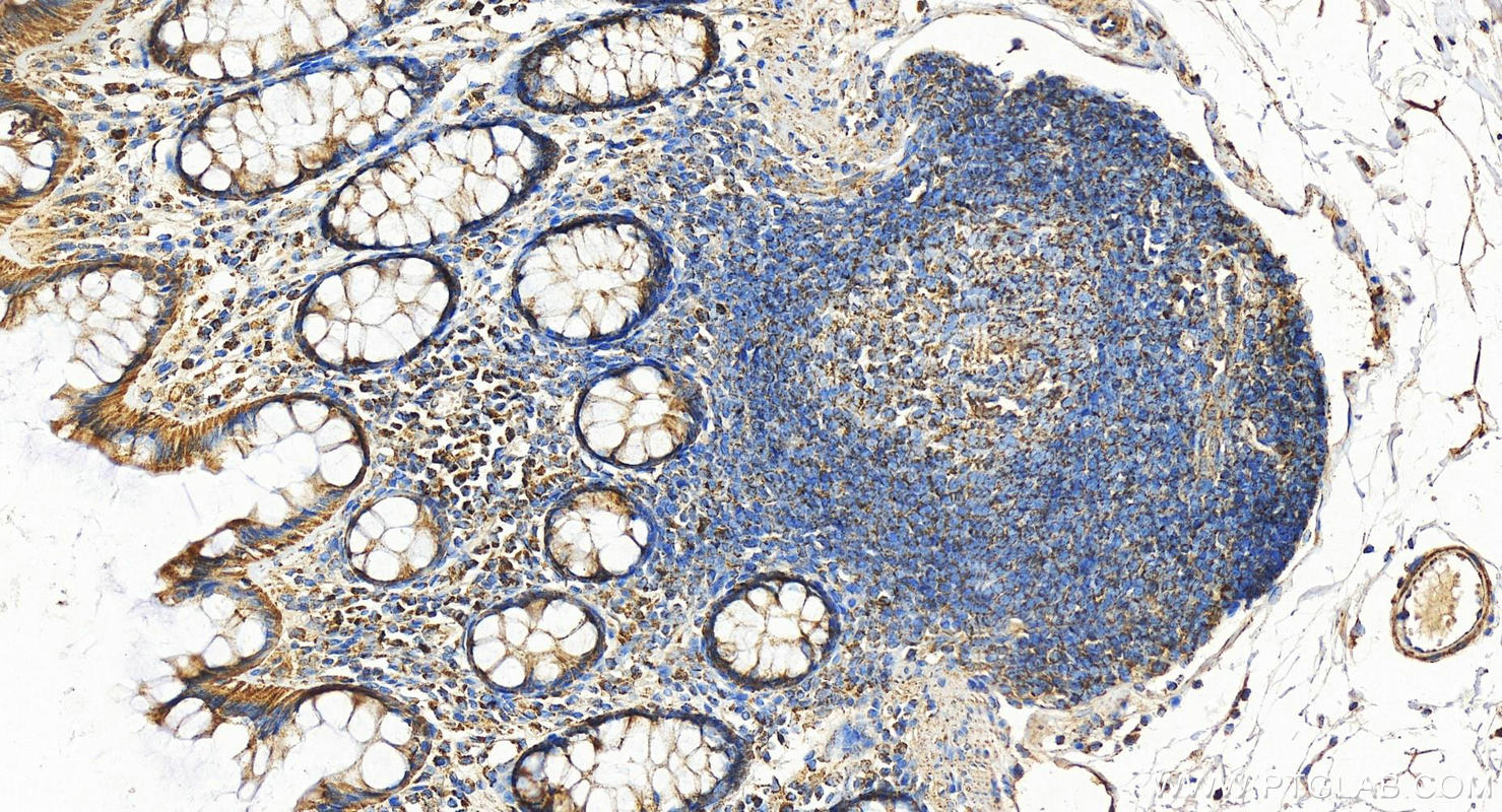 Immunohistochemistry (IHC) staining of human colon tissue using Aconitase 2 Polyclonal antibody (11134-1-AP)