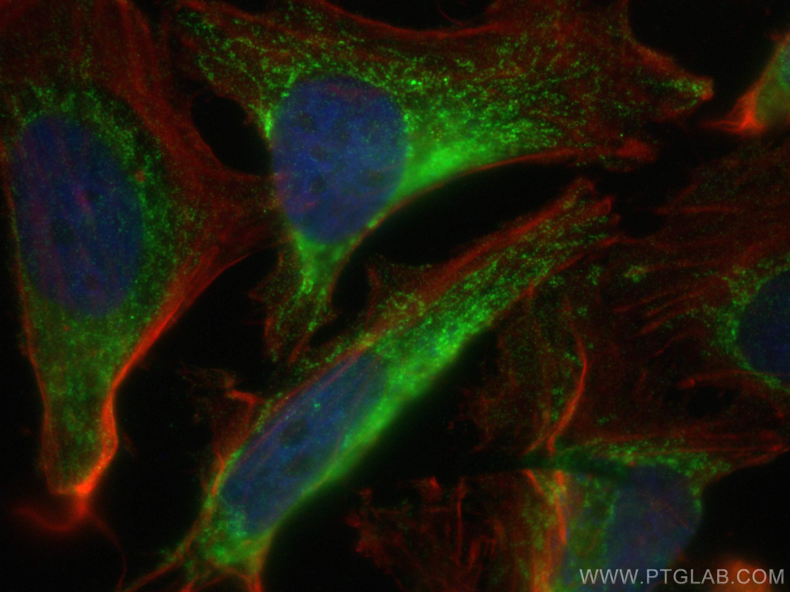 Immunofluorescence (IF) / fluorescent staining of HeLa cells using Aconitase 2 Polyclonal antibody (11134-1-AP)