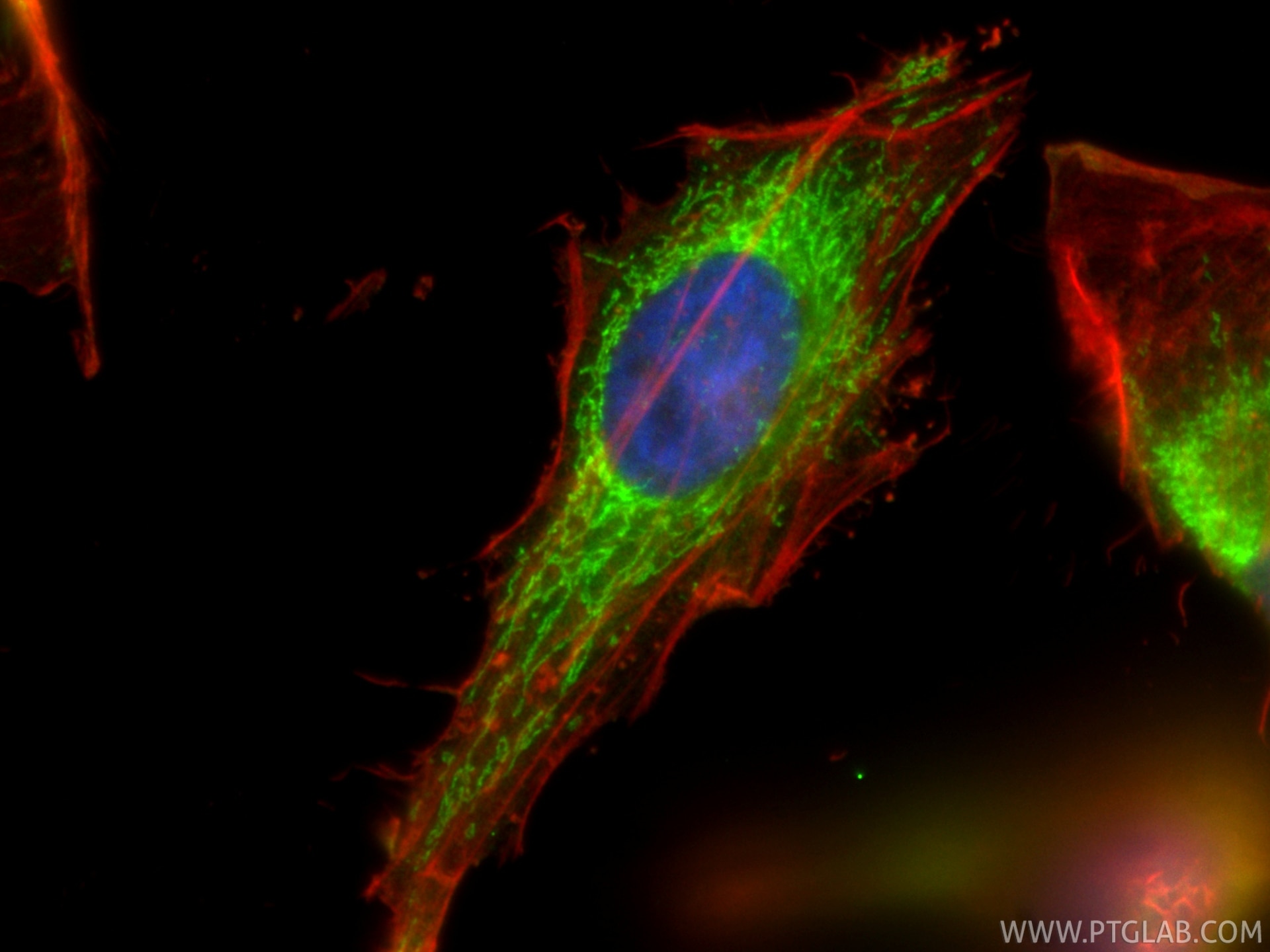 Immunofluorescence (IF) / fluorescent staining of HeLa cells using Aconitase 2 Polyclonal antibody (11134-1-AP)