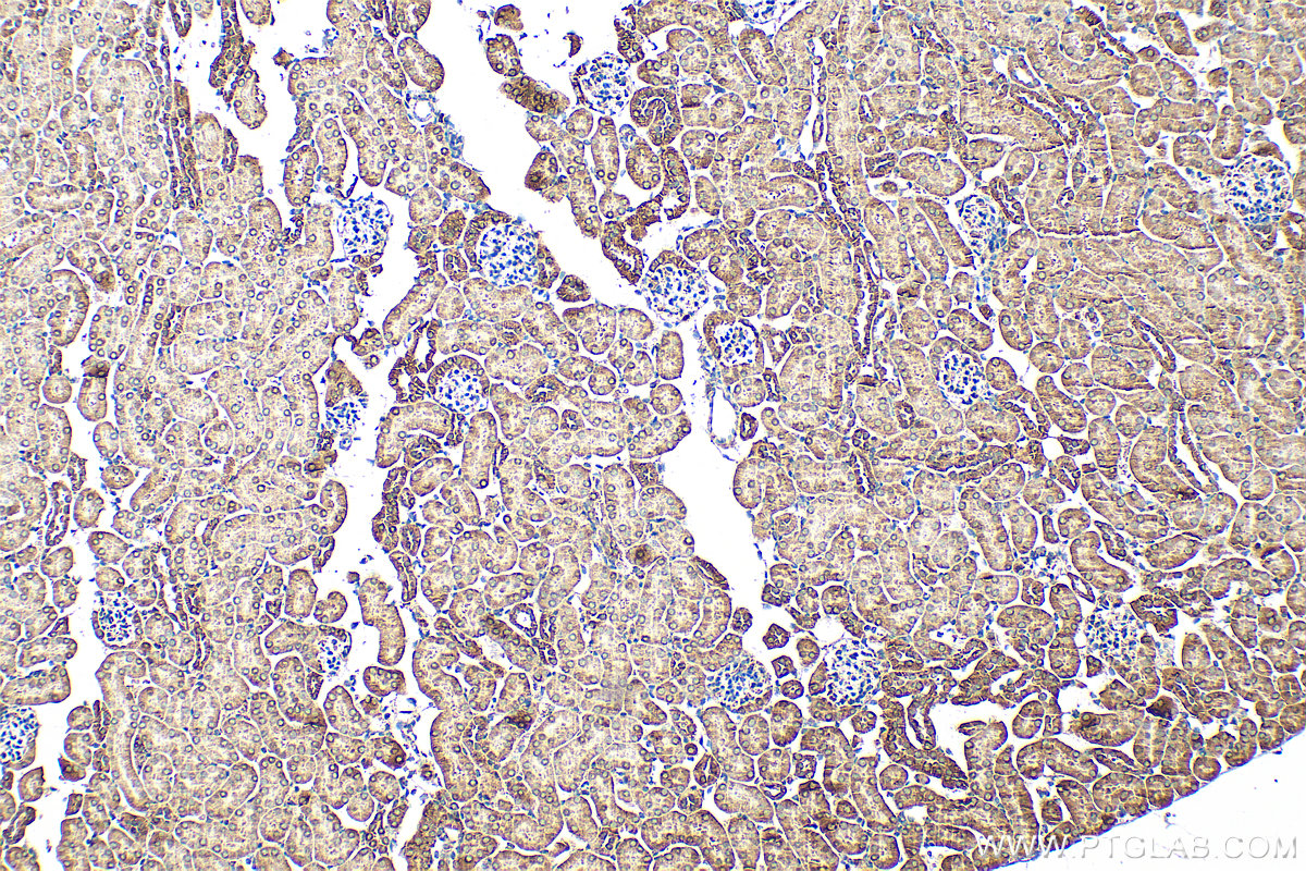 Immunohistochemistry (IHC) staining of mouse kidney tissue using Aconitase 2 Polyclonal antibody (11134-1-AP)