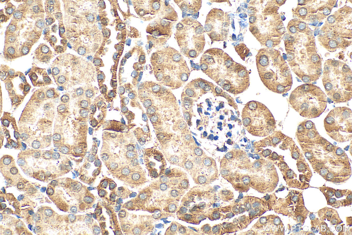 Immunohistochemistry (IHC) staining of mouse kidney tissue using Aconitase 2 Polyclonal antibody (11134-1-AP)