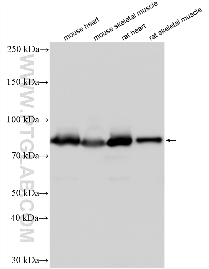 Western Blot (WB) analysis of various lysates using Aconitase 2 Polyclonal antibody (11134-1-AP)