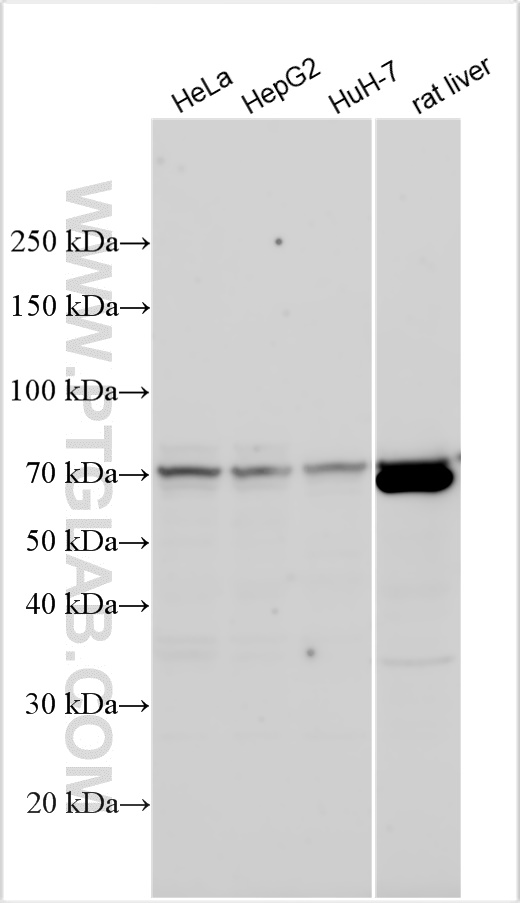 Western Blot (WB) analysis of various lysates using ACOT12 Polyclonal antibody (17871-1-AP)