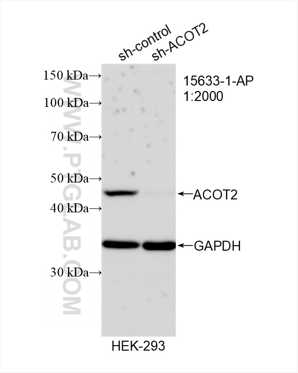 Western Blot (WB) analysis of HEK-293 cells using ACOT2 Polyclonal antibody (15633-1-AP)