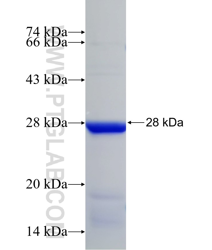 ACOT4 fusion protein Ag11271 SDS-PAGE