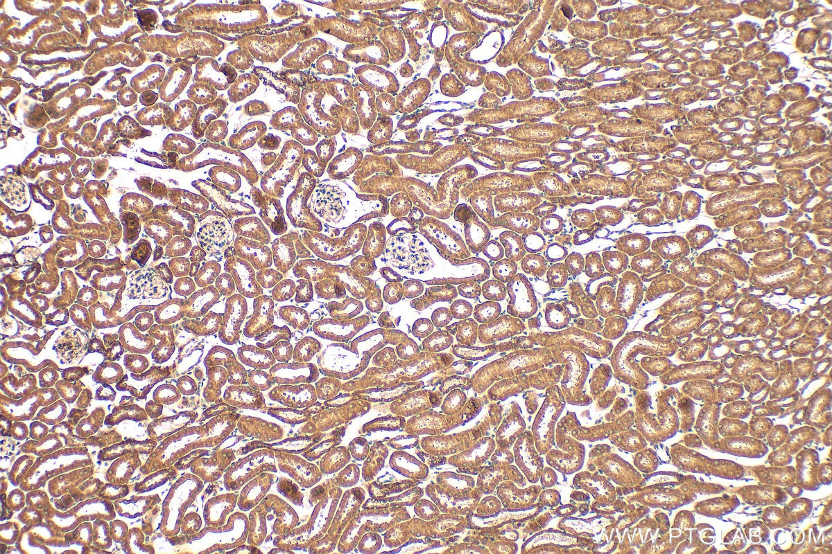 Immunohistochemistry (IHC) staining of mouse kidney tissue using ACOX1 Monoclonal antibody (68017-1-Ig)