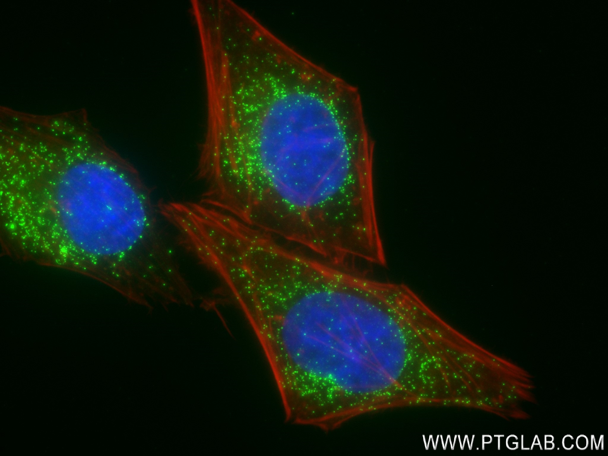 Immunofluorescence (IF) / fluorescent staining of HepG2 cells using ACOX1 Recombinant antibody (83731-1-RR)