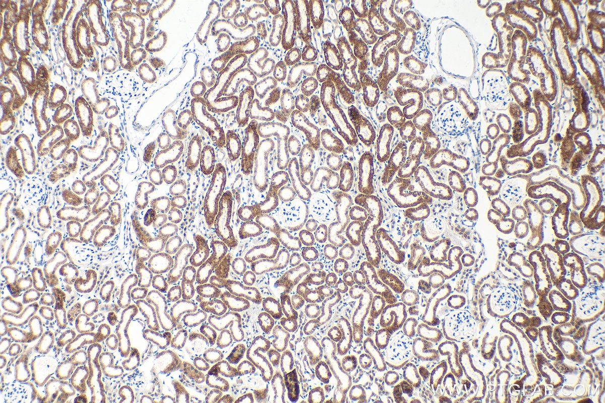 Immunohistochemistry (IHC) staining of mouse kidney tissue using ACOX1 Recombinant monoclonal antibody (83731-2-RR)