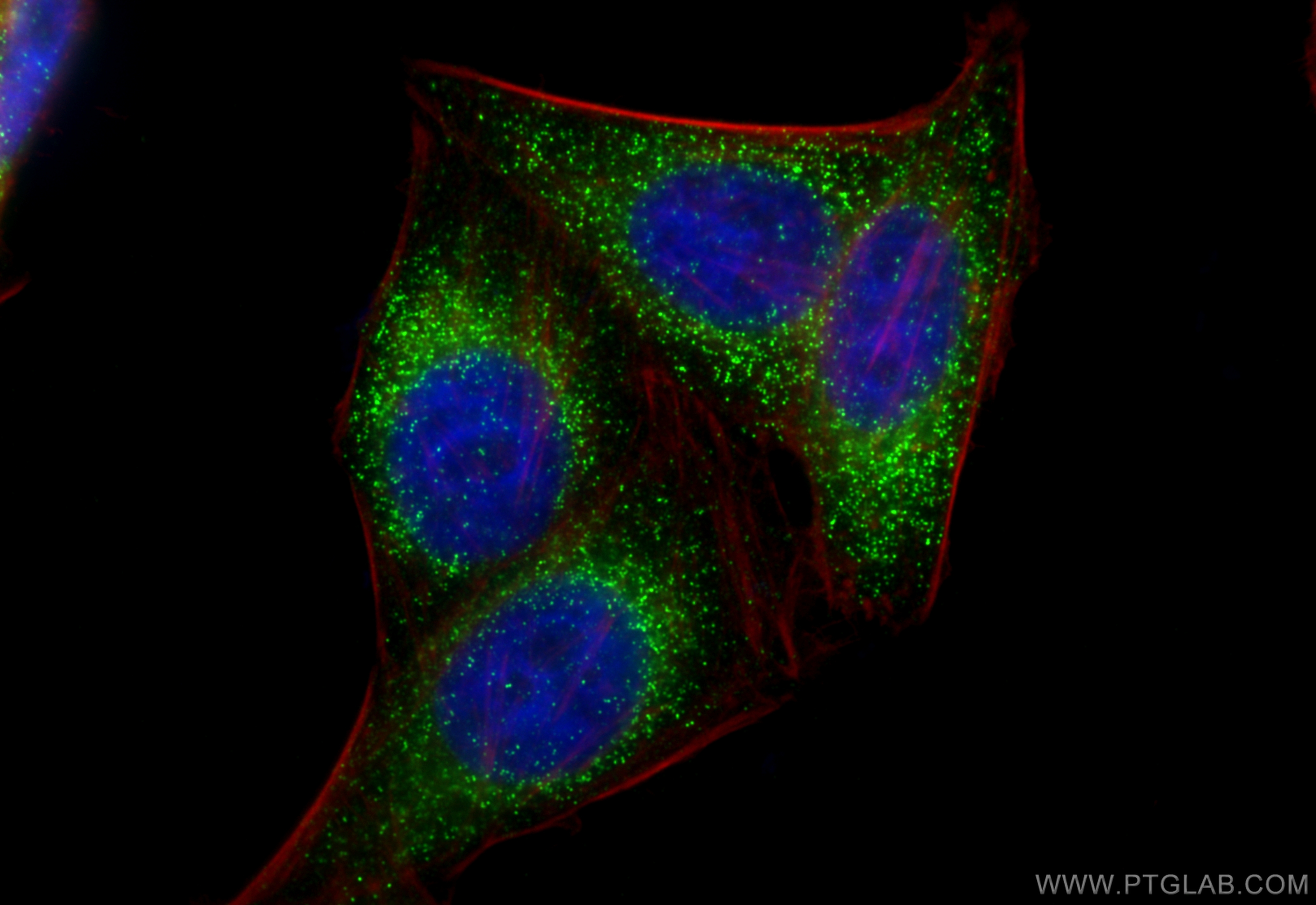Immunofluorescence (IF) / fluorescent staining of HepG2 cells using Multi-rAb™ ACOX1 Multi-Recombinant antibody (RMX00007)