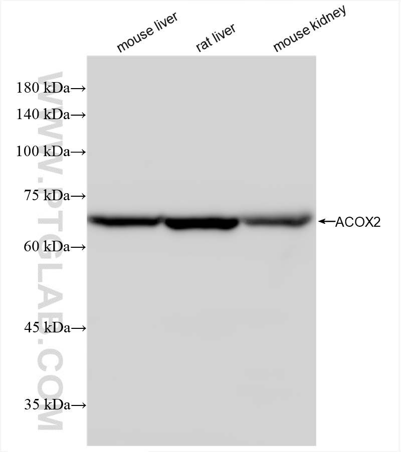 Western Blot (WB) analysis of various lysates using ACOX2 Recombinant antibody (85136-1-RR)