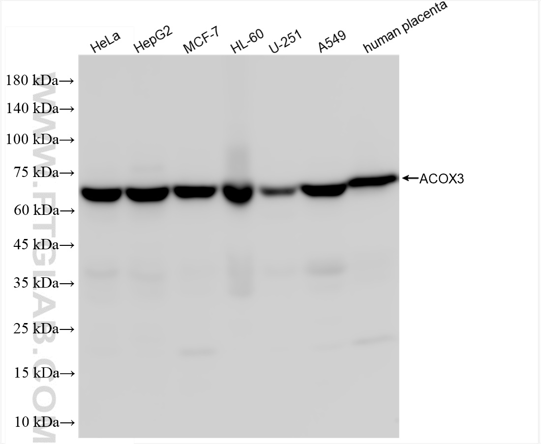 Western Blot (WB) analysis of various lysates using ACOX3 Recombinant antibody (84027-4-RR)