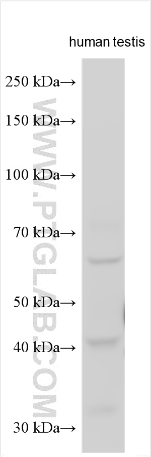 Western Blot (WB) analysis of various lysates using ACRBP Polyclonal antibody (12487-1-AP)