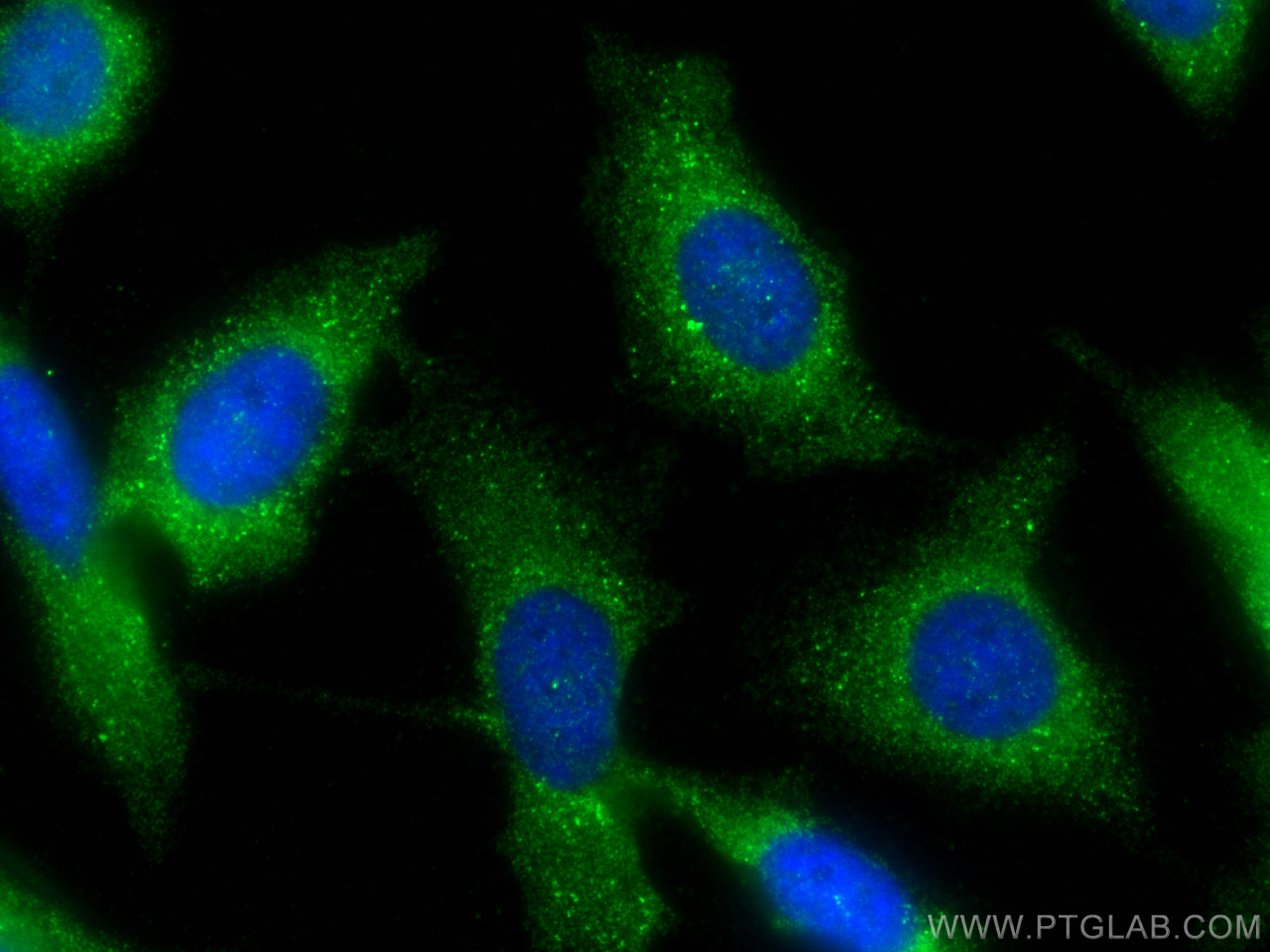 Immunofluorescence (IF) / fluorescent staining of PC-3 cells using ACRV1 Polyclonal antibody (14040-1-AP)