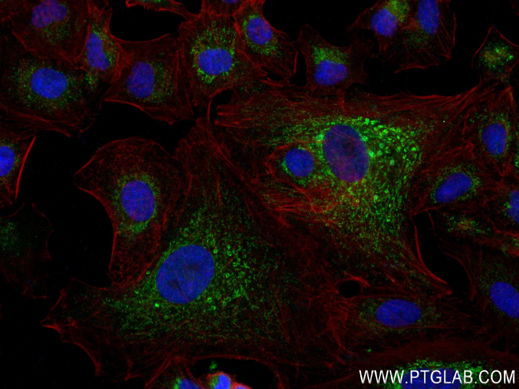 Immunofluorescence (IF) / fluorescent staining of A549 cells using ACSF2 Recombinant antibody (84033-2-RR)