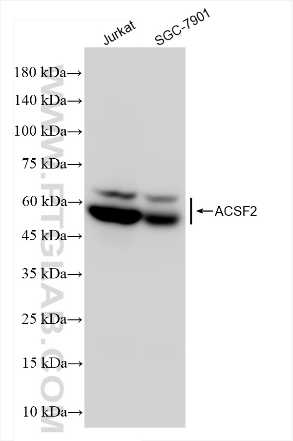 Western Blot (WB) analysis of various lysates using ACSF2 Recombinant antibody (84033-3-RR)