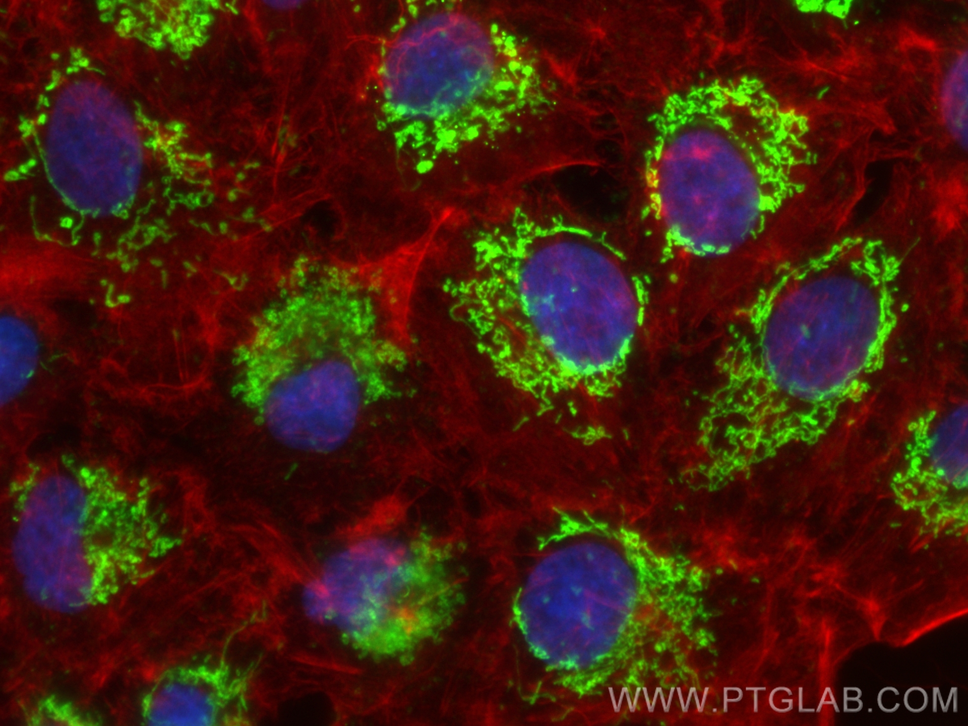 Immunofluorescence (IF) / fluorescent staining of A549 cells using CoraLite® Plus 488-conjugated ACSF2 Recombinant an (CL488-84033-2)