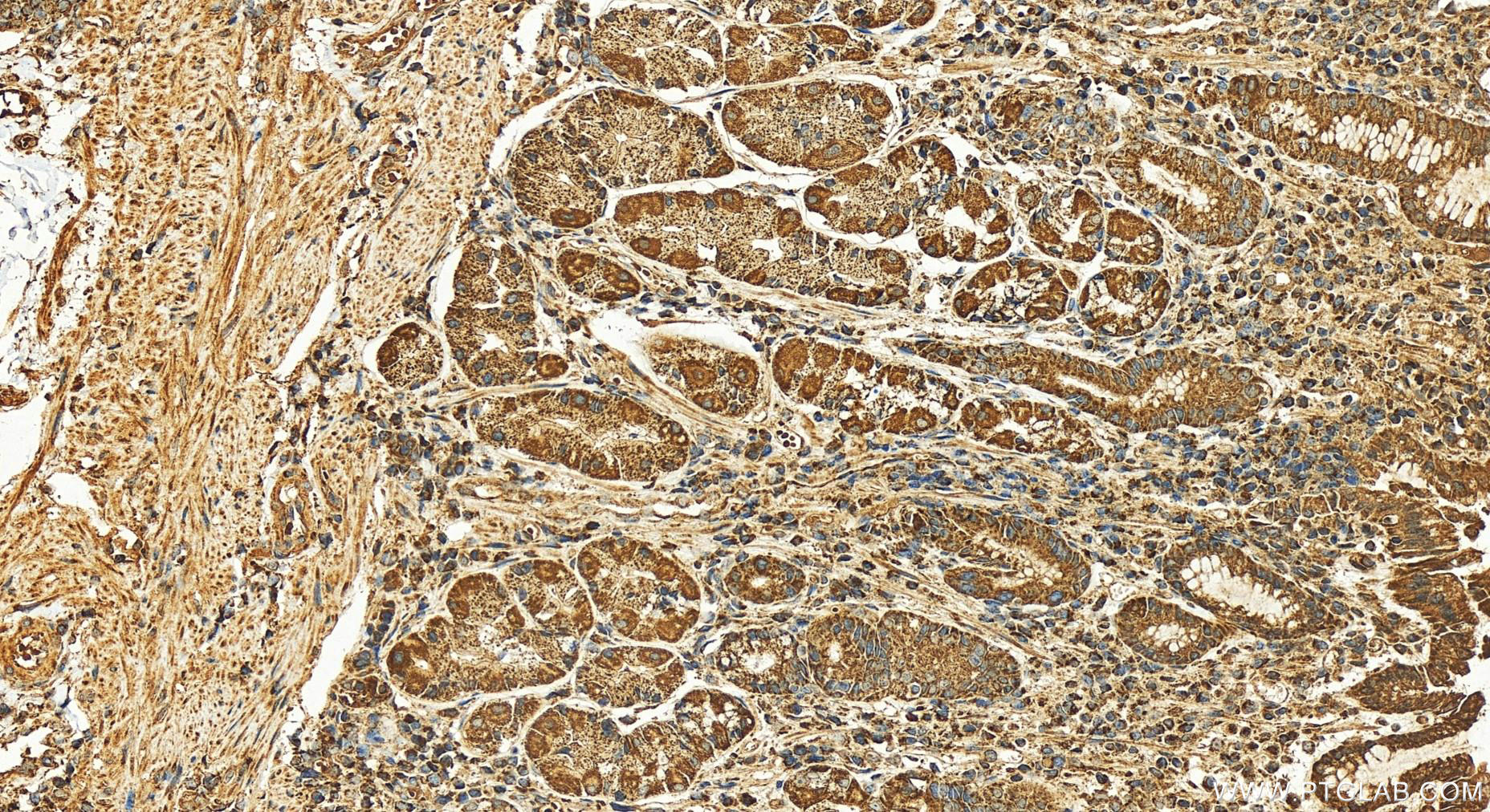 Immunohistochemistry (IHC) staining of human stomach tissue using ACSF3 Polyclonal antibody (25484-1-AP)