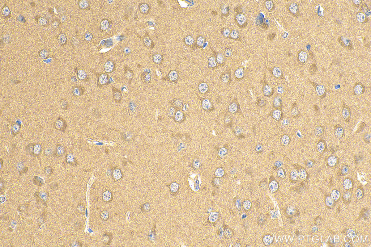 Immunohistochemistry (IHC) staining of mouse brain tissue using ACSL4/FACL4 Polyclonal antibody (22401-1-AP)