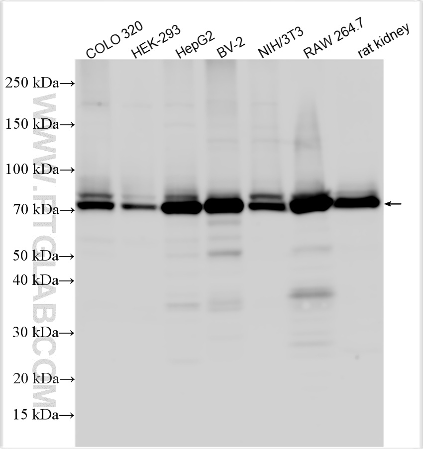 Western Blot (WB) analysis of various lysates using ACSL4/FACL4 Polyclonal antibody (22401-1-AP)