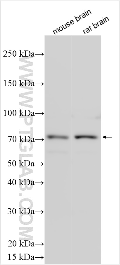 Western Blot (WB) analysis of various lysates using ACSL6 Polyclonal antibody (13847-1-AP)