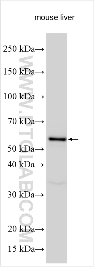 Western Blot (WB) analysis of various lysates using ACSM5 Polyclonal antibody (16591-1-AP)