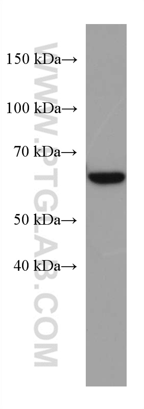 Western Blot (WB) analysis of 4T1 cells using ACSM5 Monoclonal antibody (67334-1-Ig)