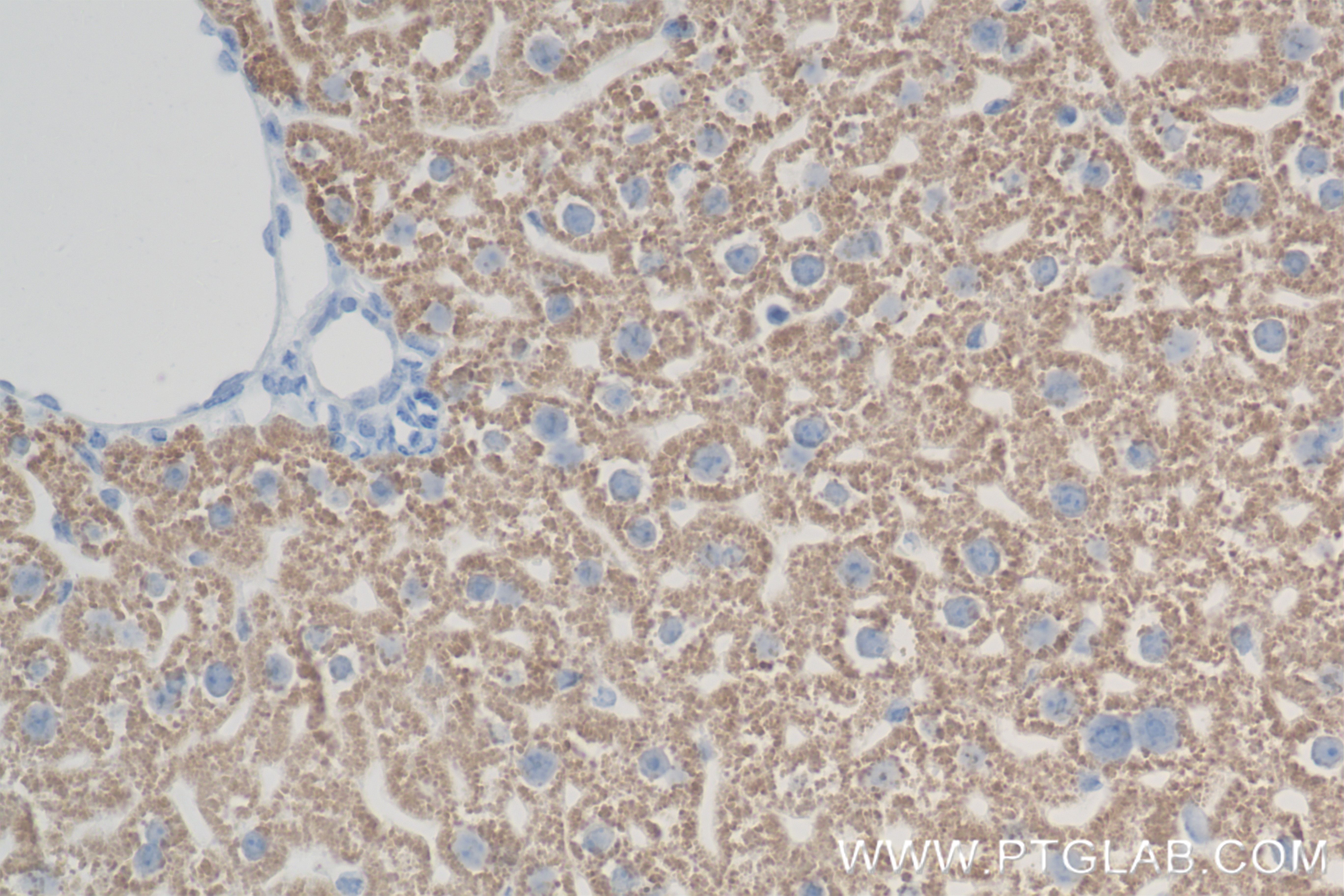 Immunohistochemistry (IHC) staining of mouse liver tissue using ACSM5 Recombinant antibody (84444-1-RR)
