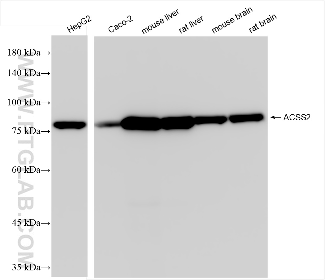 Western Blot (WB) analysis of various lysates using ACSS2 Recombinant antibody (84774-7-RR)