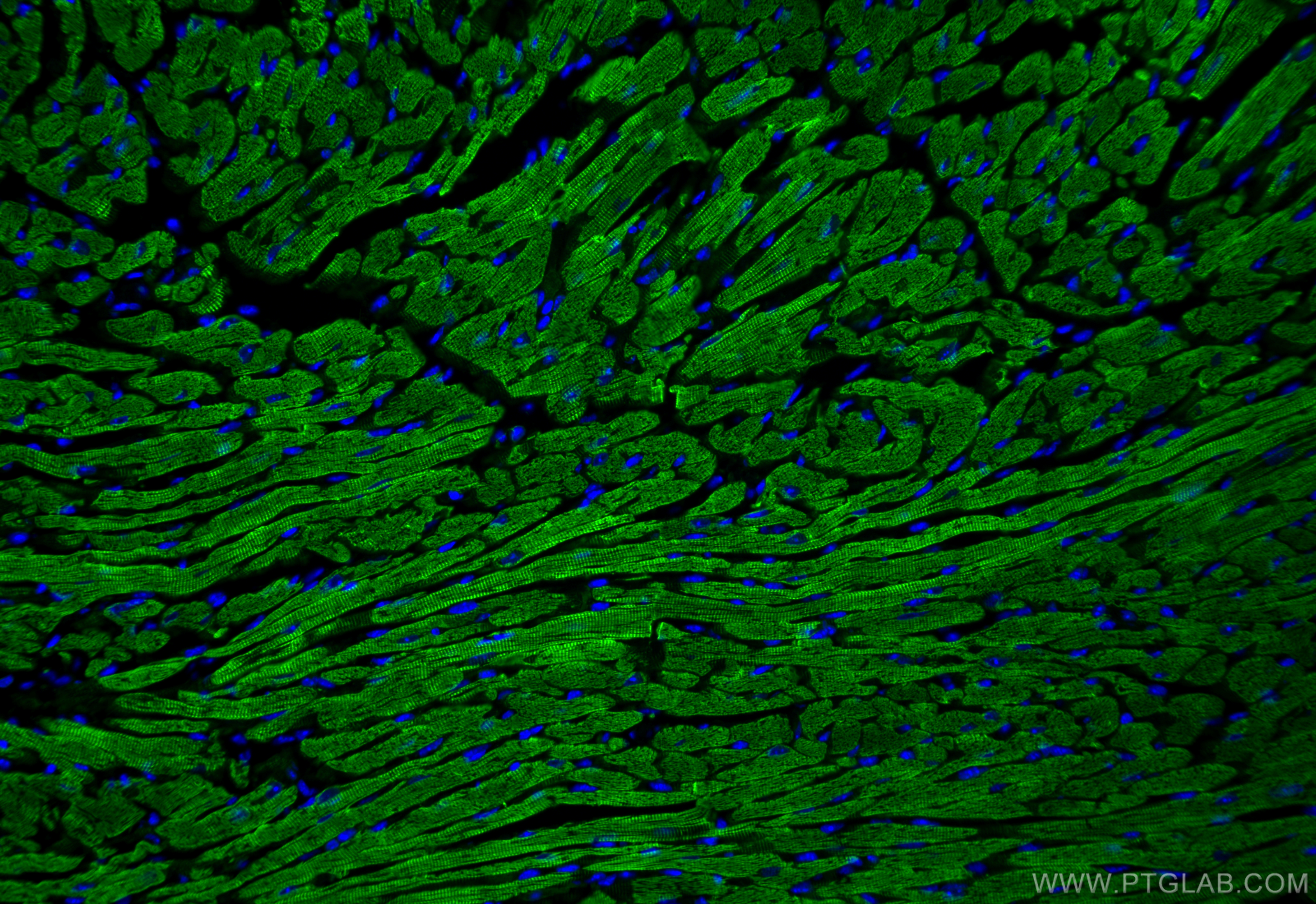 Immunofluorescence (IF) / fluorescent staining of mouse heart tissue using Alpha Actin Polyclonal antibody (23660-1-AP)