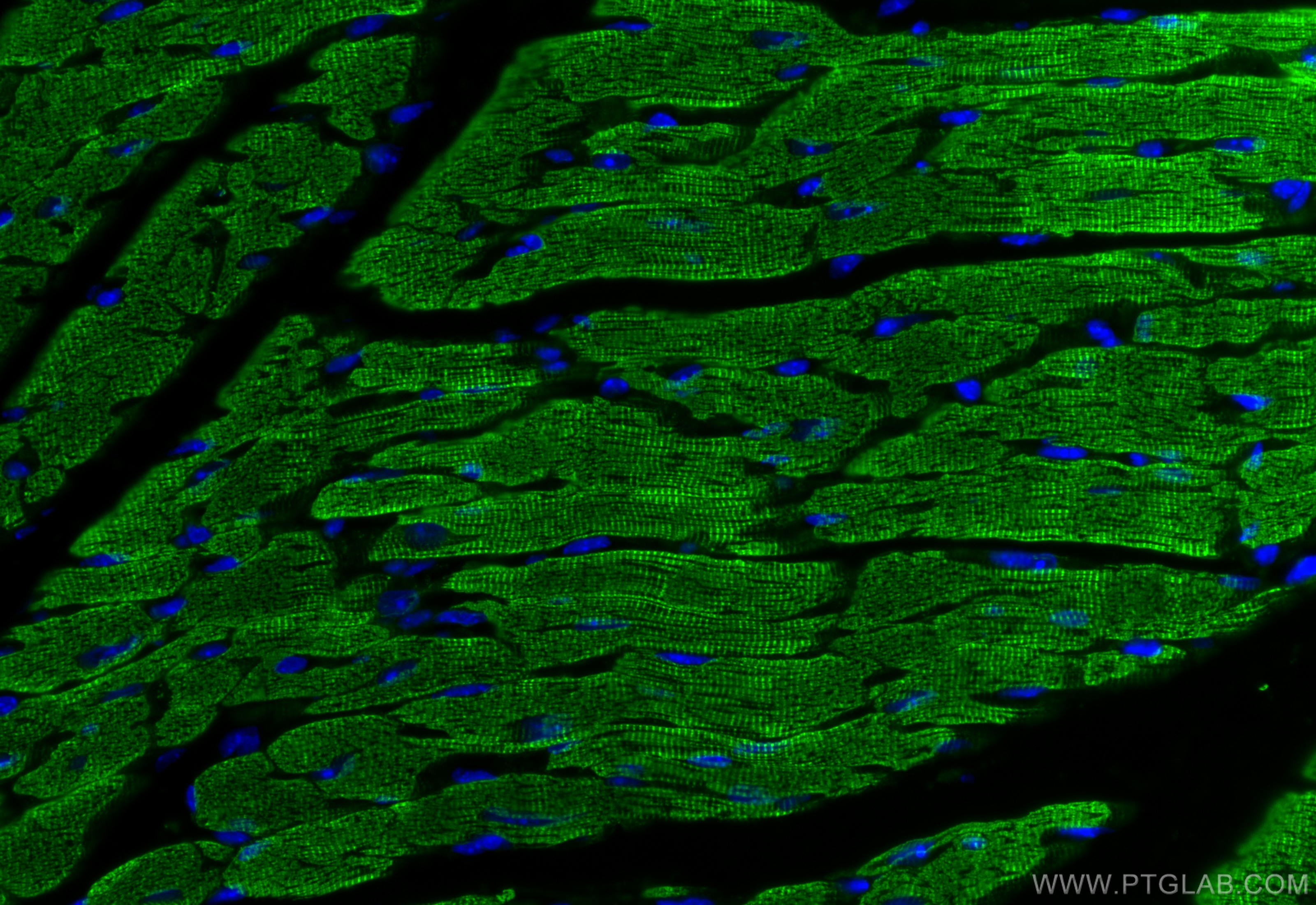 Immunofluorescence (IF) / fluorescent staining of mouse heart tissue using Alpha Actin Polyclonal antibody (23660-1-AP)